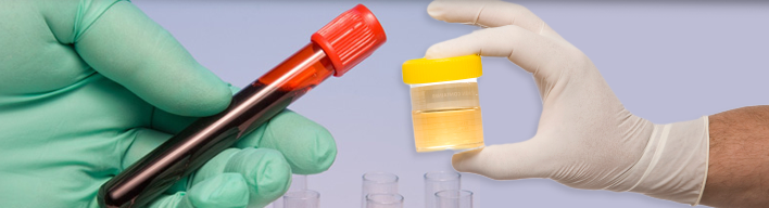 Normal Urine Test Results Chart Pus Cells