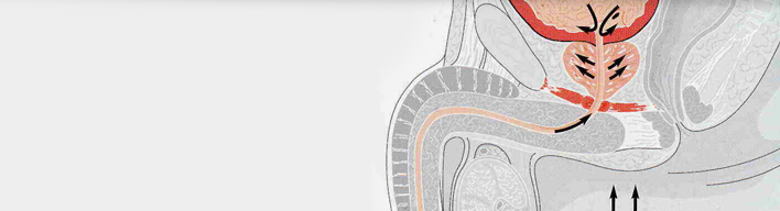 Prostatitis 35 év alatt